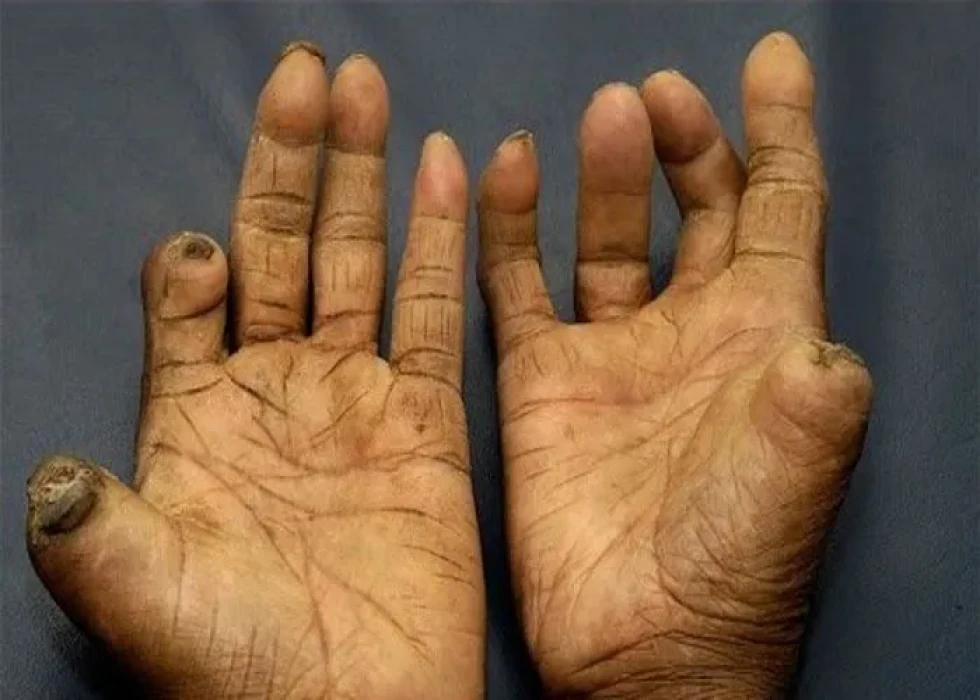 Sajilo Khoj